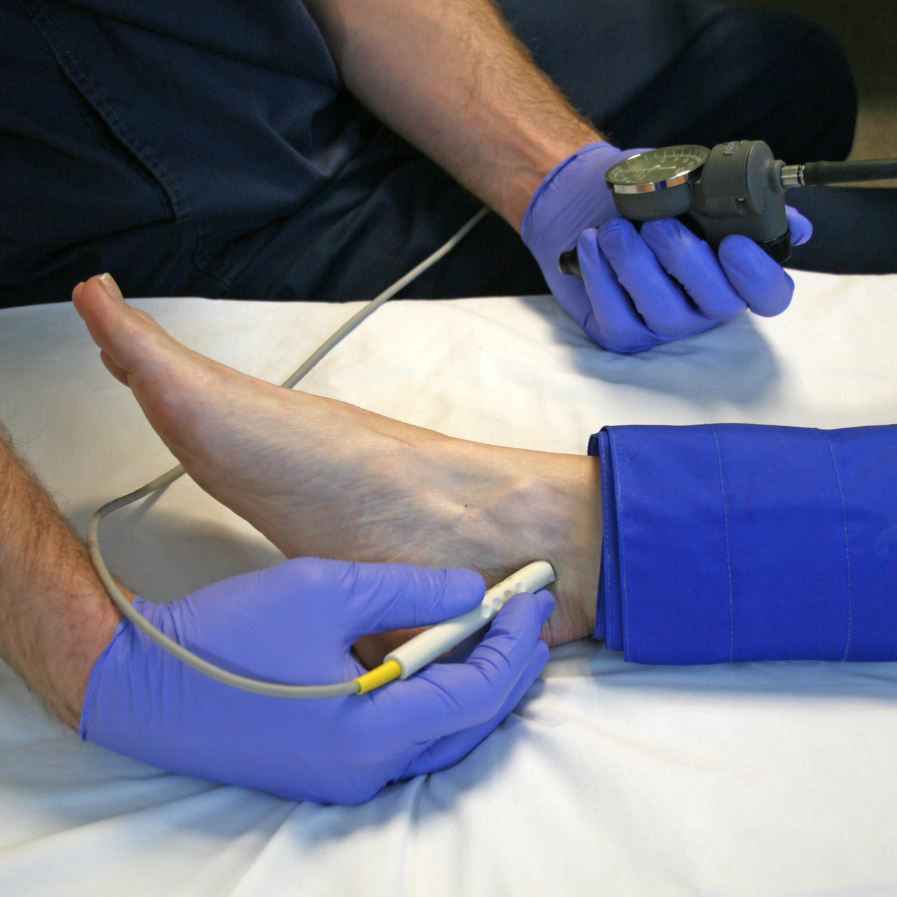Измерение артериального давления на нижних конечностях