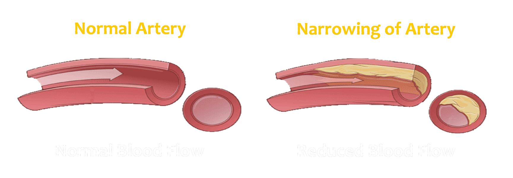 the-endothelium-the-inner-layer-of-the-blood-vessel-vazzello