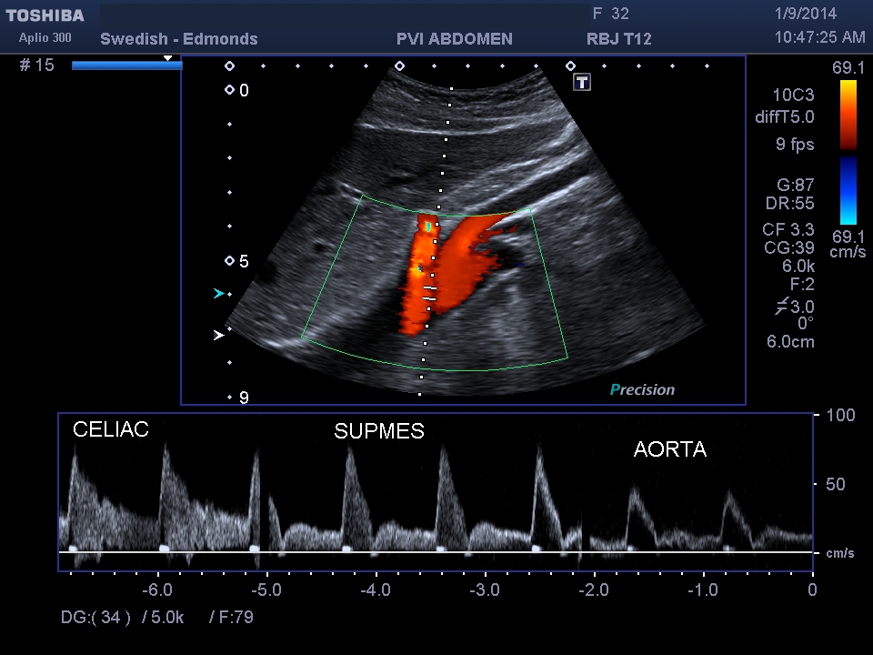 Vascular Ultrasound Exams Commonly Ordered